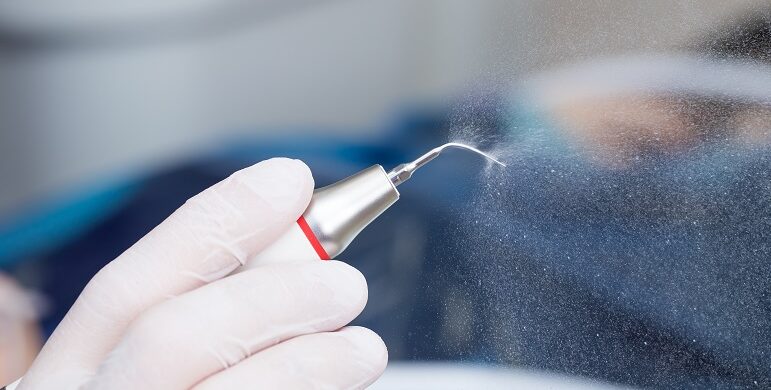 como funciona la limpieza dental ultrasonica